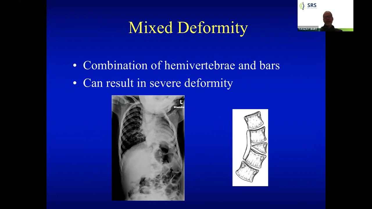 Pediatric Congenital Deformity - San Diego Fellows April 26, 2021
