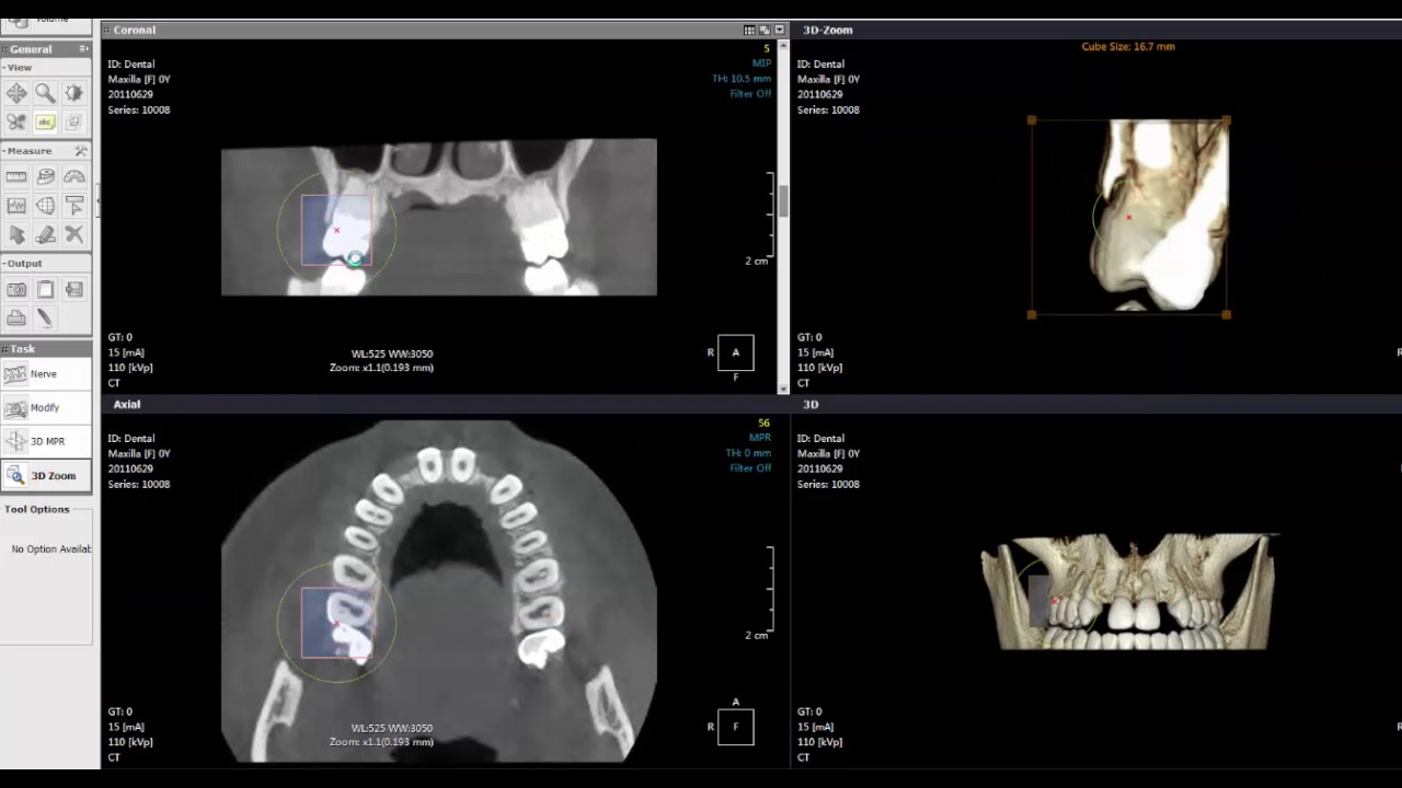 Cybermed OnDemand3D Dental diagnosis