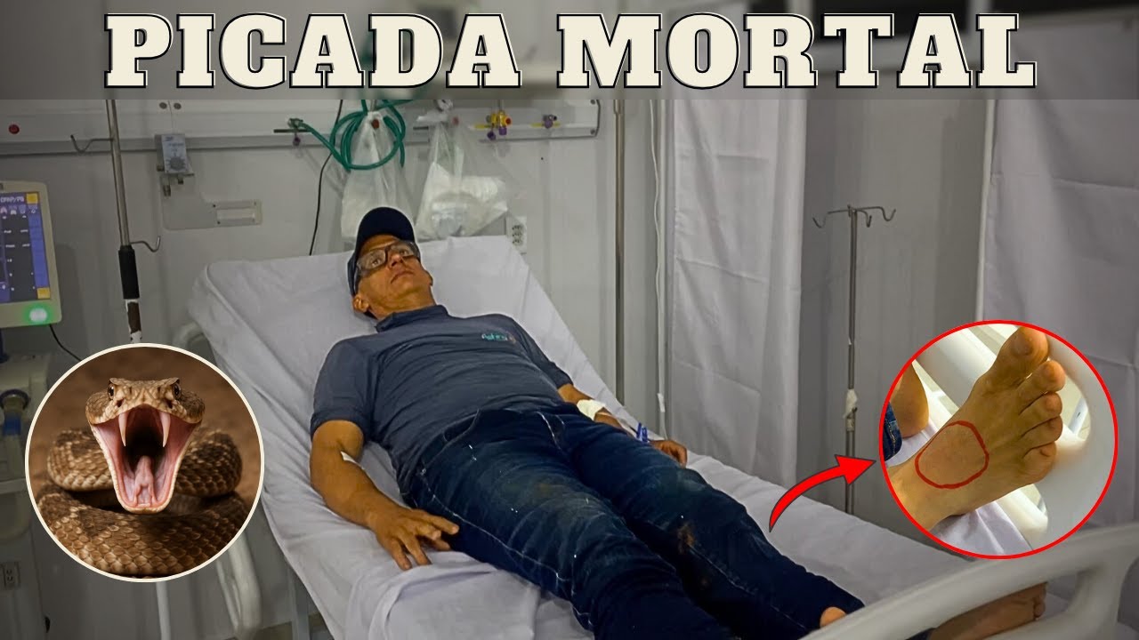 TODO CUIDADO É POUCO | JAVALI BRASIL