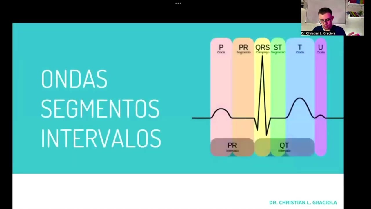 ECG