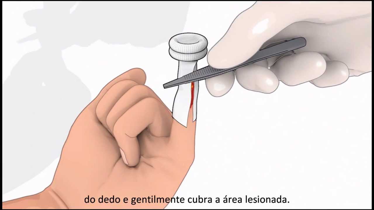 ADAPTIC DIGIT Malha Não Aderente Digital - Modo de usar