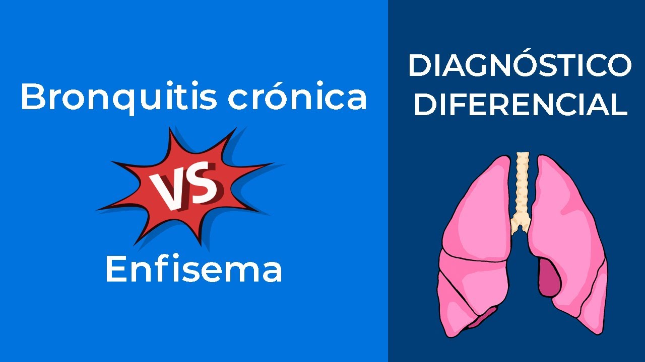 Diagnóstico Diferencial. Bronquitis crónica vs Enfisema