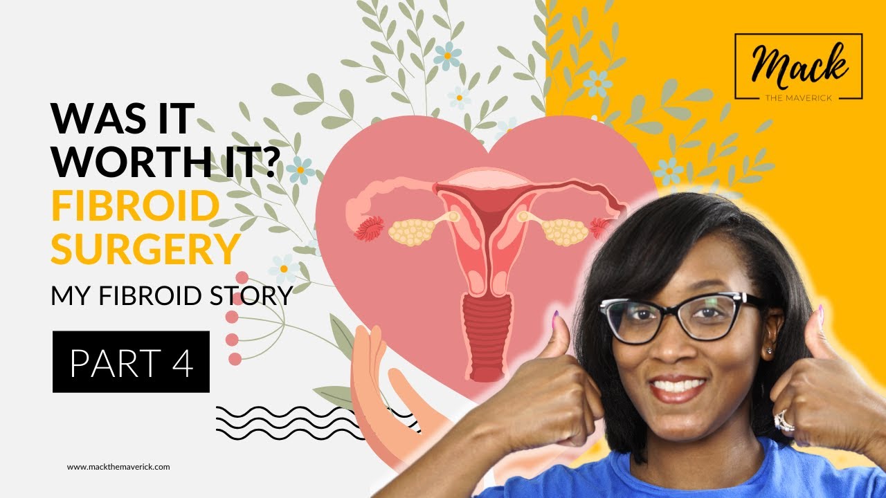 Life After Fibroid Surgery| One Year Open Myomectomy Update