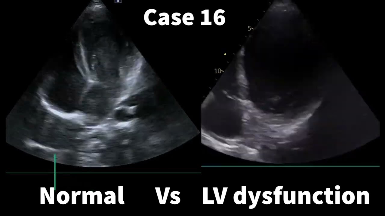 Test your skill. Spot the difference between normal Vx abnormal