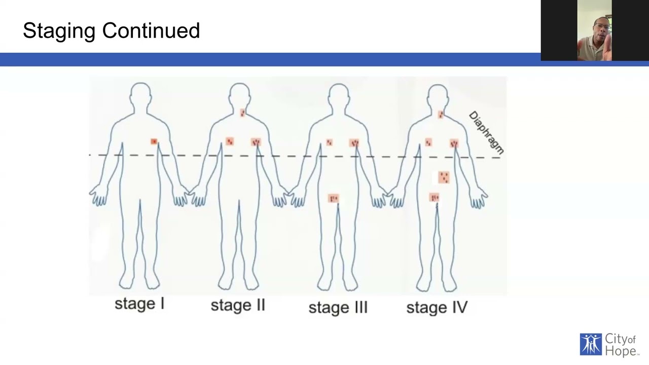 Treatment options for DLBCL