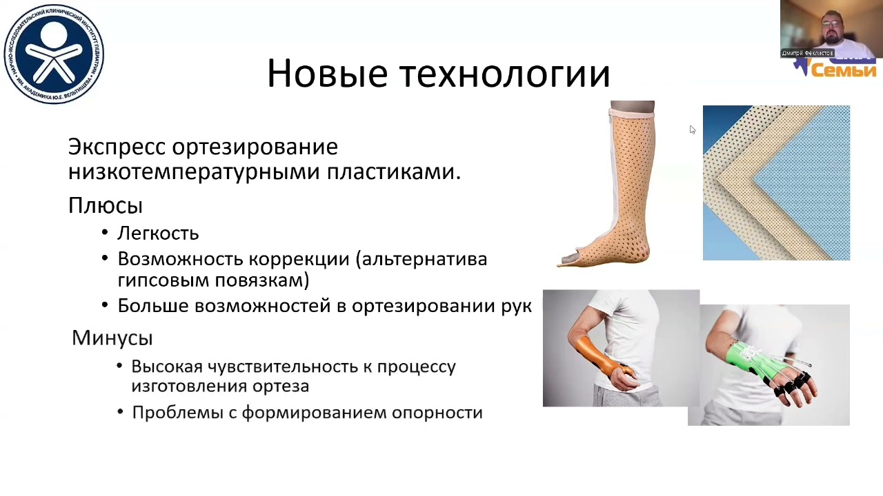 Подходы к работе с двигательными нарушениями при СМА