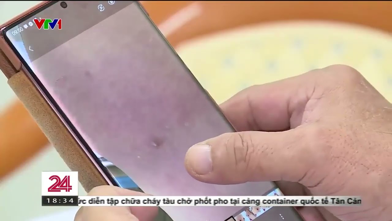 Biến chứng nguy hiểm của việc tiêm tan mỡ trôi nổi | VTV24