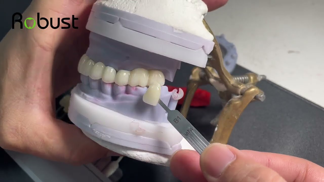 What is the best zirconia bridge
