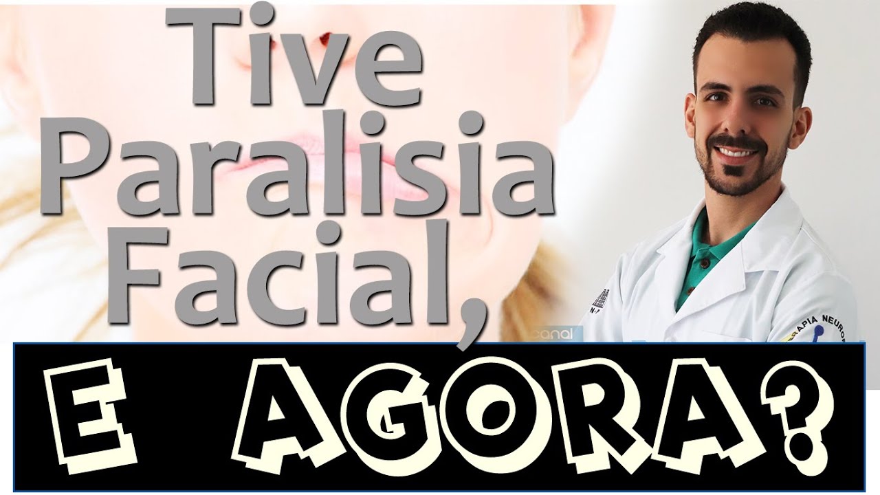 PARALISIA FACIAL? O que fazer? O que n&atilde;o fazer? Cuidados Importantes - Dr. Rog&eacute;rio Souza