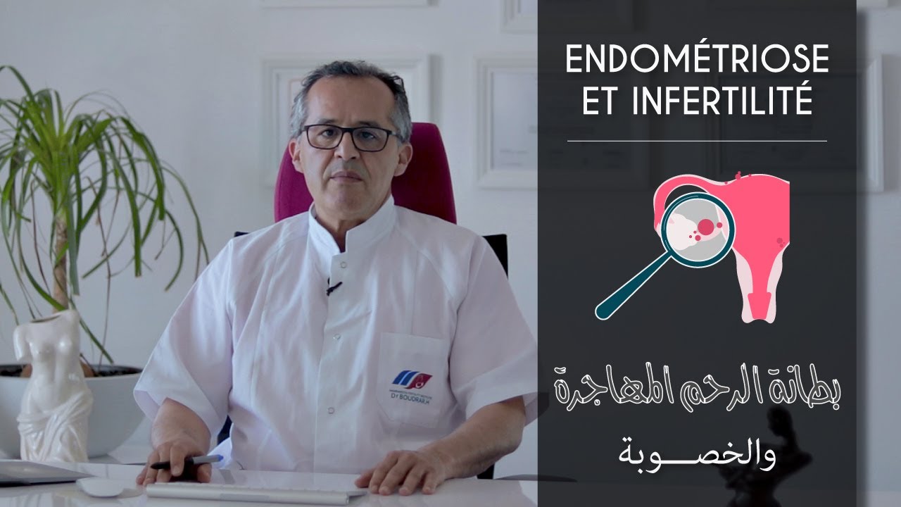 Endométriose et infertilité - بطانة الرحم المهاجرة والخصوبة
