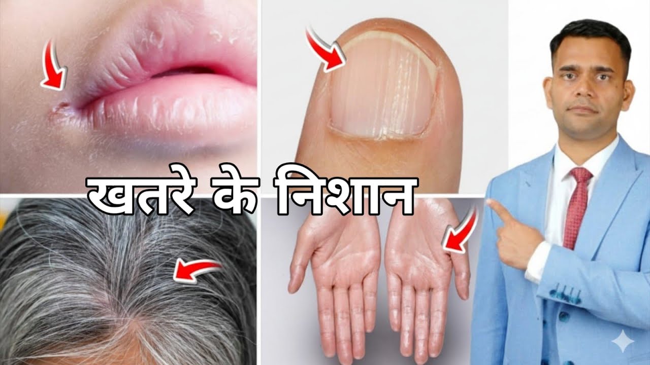 संकेत जो शरीर देता है बड़ी बीमारी से पहले | Warning Signs that Our Body Gives 