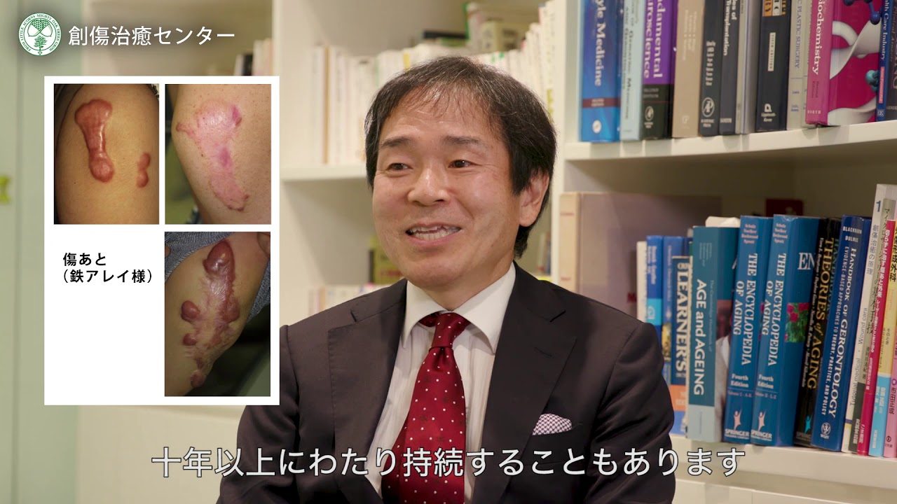 ケロイド・肥厚性瘢痕と呼ばれるキズあとの治療