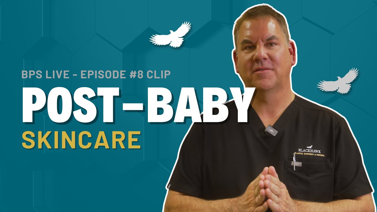 🌟 How to Treat Acne & Dark Spots After Pregnancy | Skincare Tips from Dr. Ronan