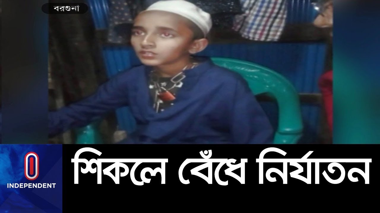 মাদ্রাসায় ছাত্রকে ৬দিন ধরে মর্মান্তিক নির্যাতন করলেন প্রধান শিক্ষক || Student Toture