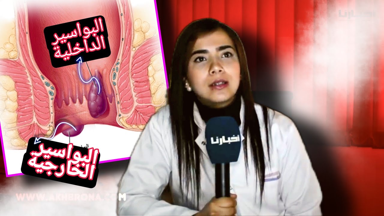 البواسير : اسبابها و طرق العلاج منها مع الدكتورة سناء مطيع