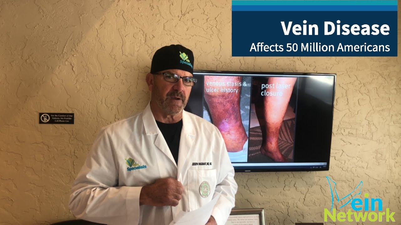 What are the signs and symptoms of vein disease?