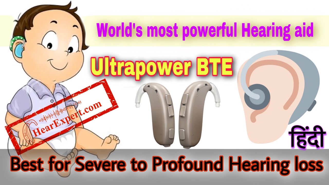 World's most powerful Hearing aid for Severe to Profound Hearing loss | Oticon Xceed Ultrapower BTE|