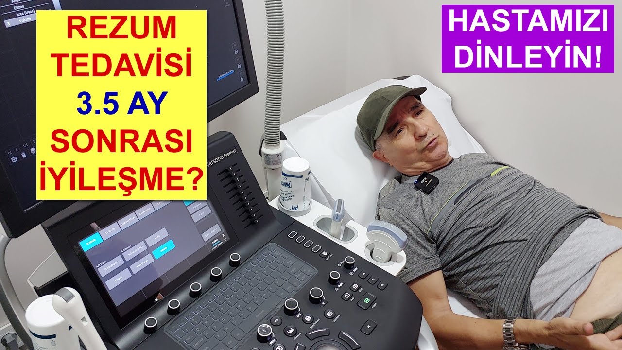 Rezum Tedavisi 3.5 Ay Sonrası İyileşme Süreci: Prostat Şikayetlerinin Güncel Durumunu Dinleyin!