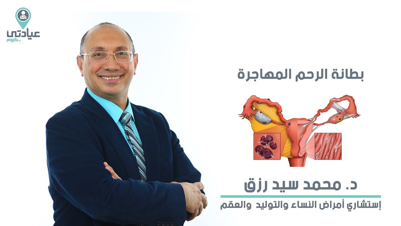 بطانة الرحم المهاجرة مع  د : محمد السيد رزق _ دكتور النساء والتوليد