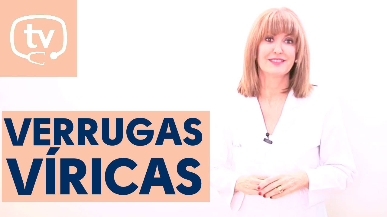 &iquest;Qu&eacute; son y c&oacute;mo se tratan las verrugas v&iacute;ricas?