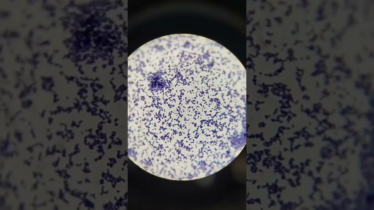 #Grams_staining
