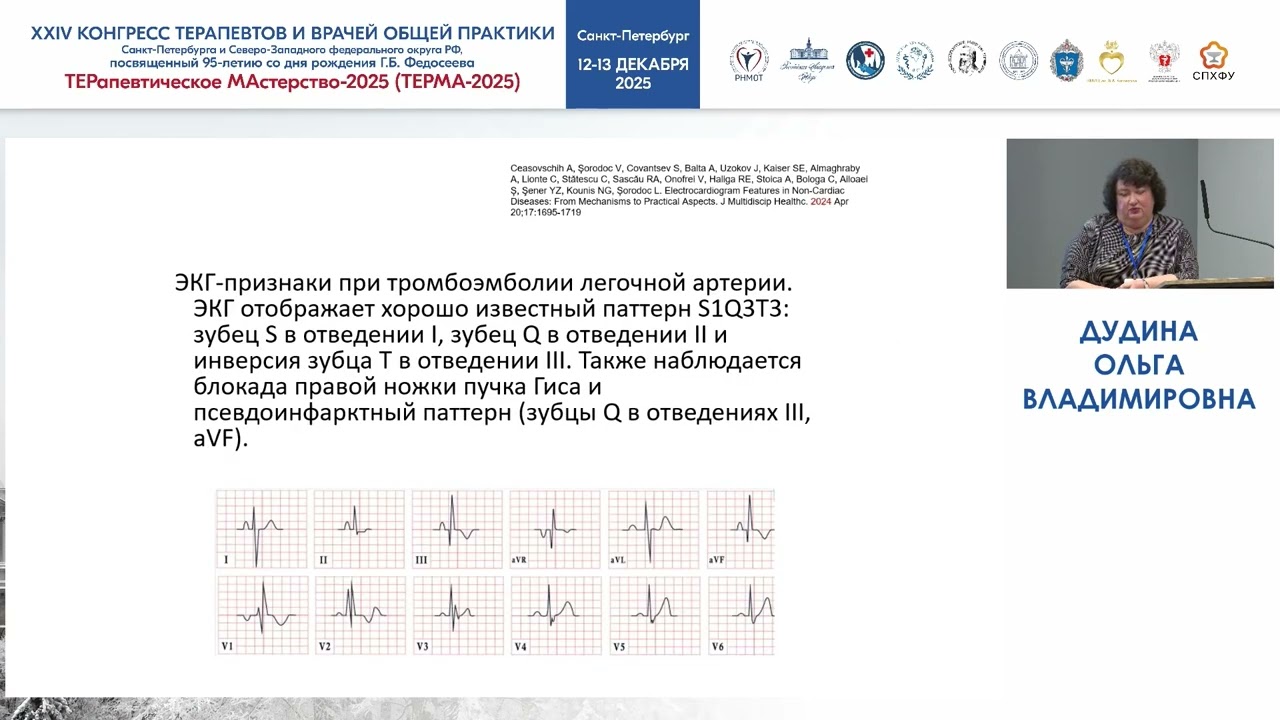 Этот пресловутый зубец Q…