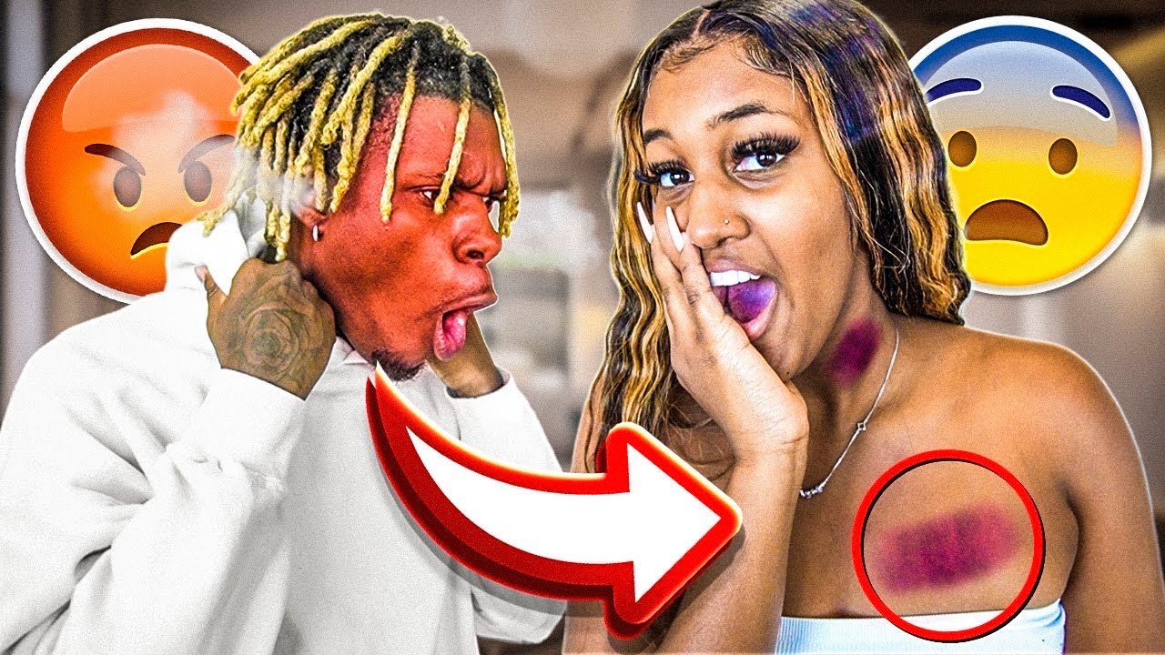 HICKEY PRANK ON KING!!!😱