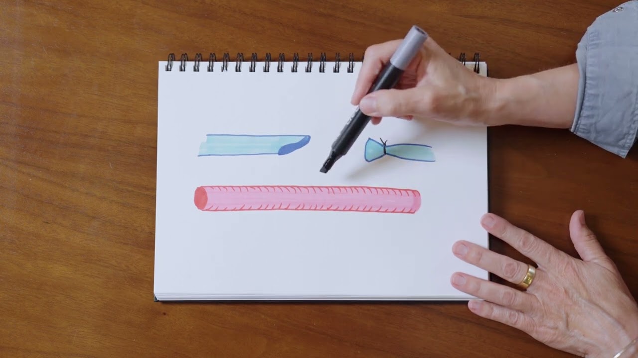 ✍️ LA CRÉATION DE FISTULE ARTERIO-VEINEUSE DESSINÉE ✍️
