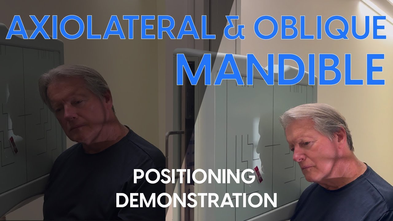 Axiolateral and Axiolateral Oblique Mandible Radiographic Positioning Demonstration