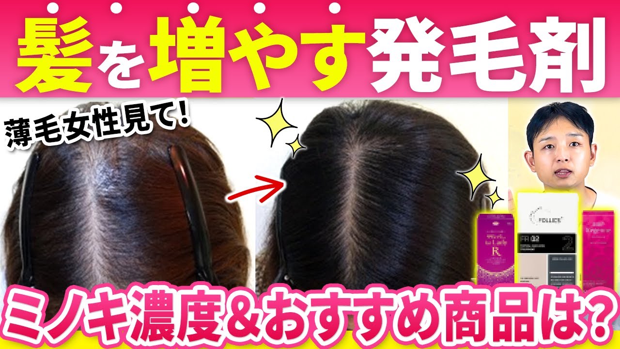 【女性の薄毛】育毛剤ではなく発毛剤(ミノキシジル)5％より〇％をオススメする理由