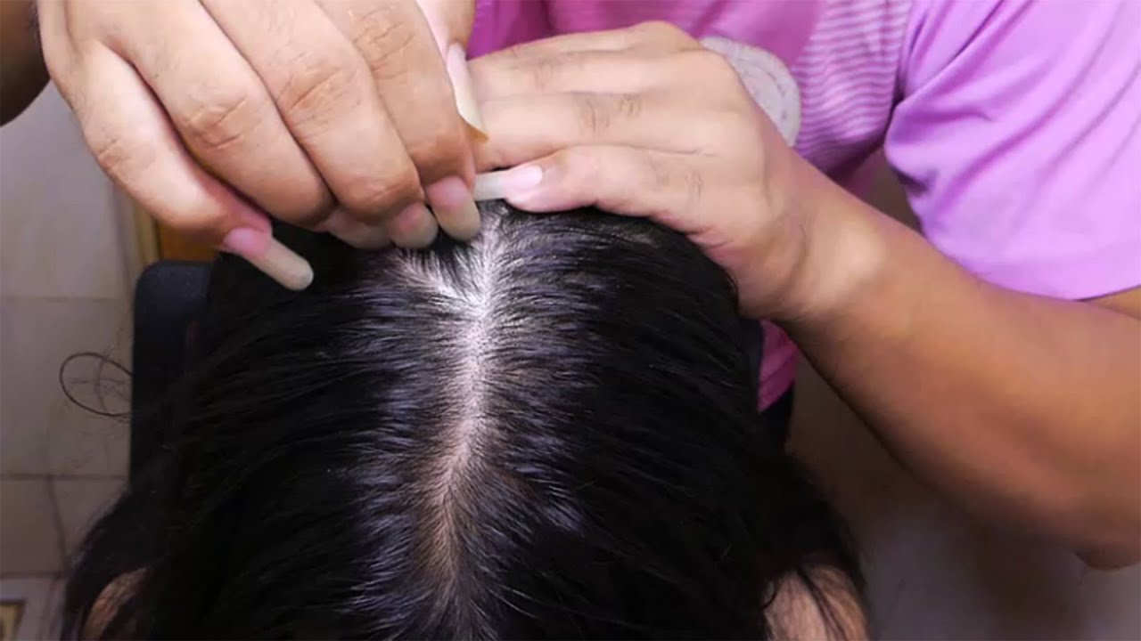 Finger Rough ASMR Fast Scratch itchy scalp, So I Did! Satisfying Scalp Scratching