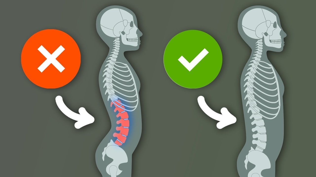 لديك تقوس أسفل الظهر؟ قم بهذه التمارين لتصحيح وضع ظهرك