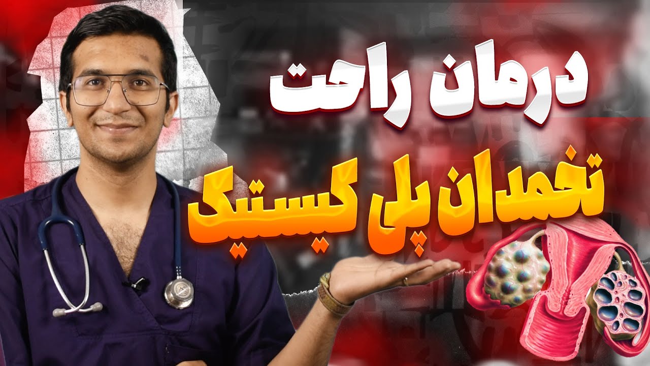 بهترین درمان تخمدان پلی کیستیک