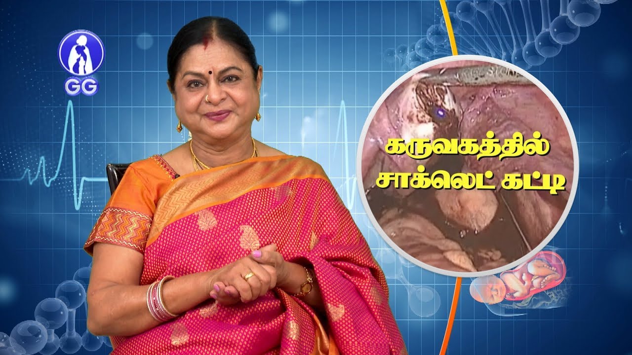 Шоколадная киста яичника - Больница GG - доктор Камала Селварадж