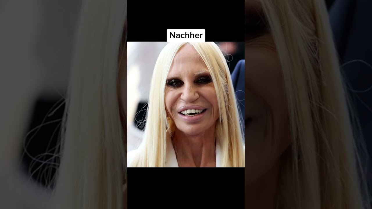 💉 Krasse Sch&ouml;nheitsoperationen, die schief gegangen
