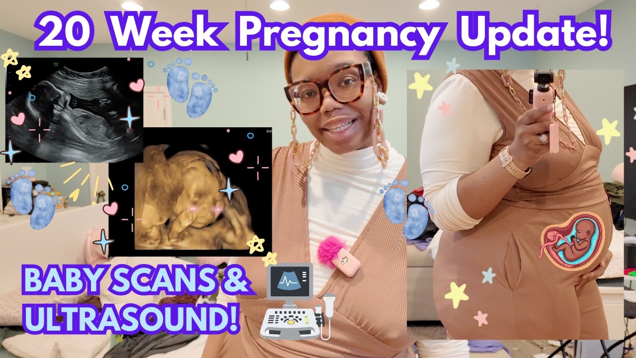 20 Weeks Pregnancy Update | Chatting about Symptoms, Mental Health, and More!