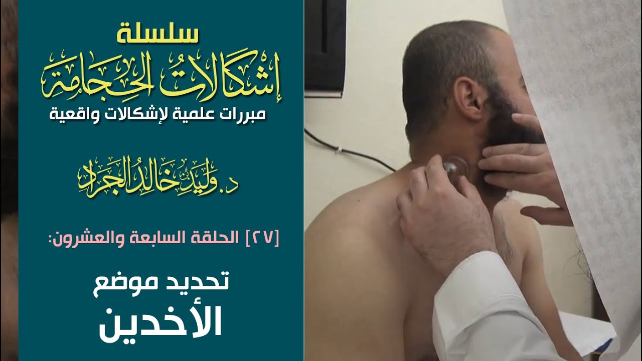 #سلسلة_إشكالات_الحجامة