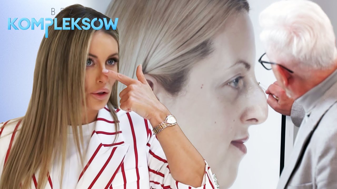 Jak wygląda operacja nosa? Nie wszędzie są kości, głównie to chrząstki 👃 | Bez kompleksów