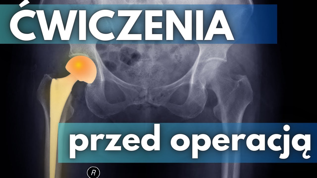 Ćwiczenia przed operacją wymiany biodra (ENDOPROTEZA)