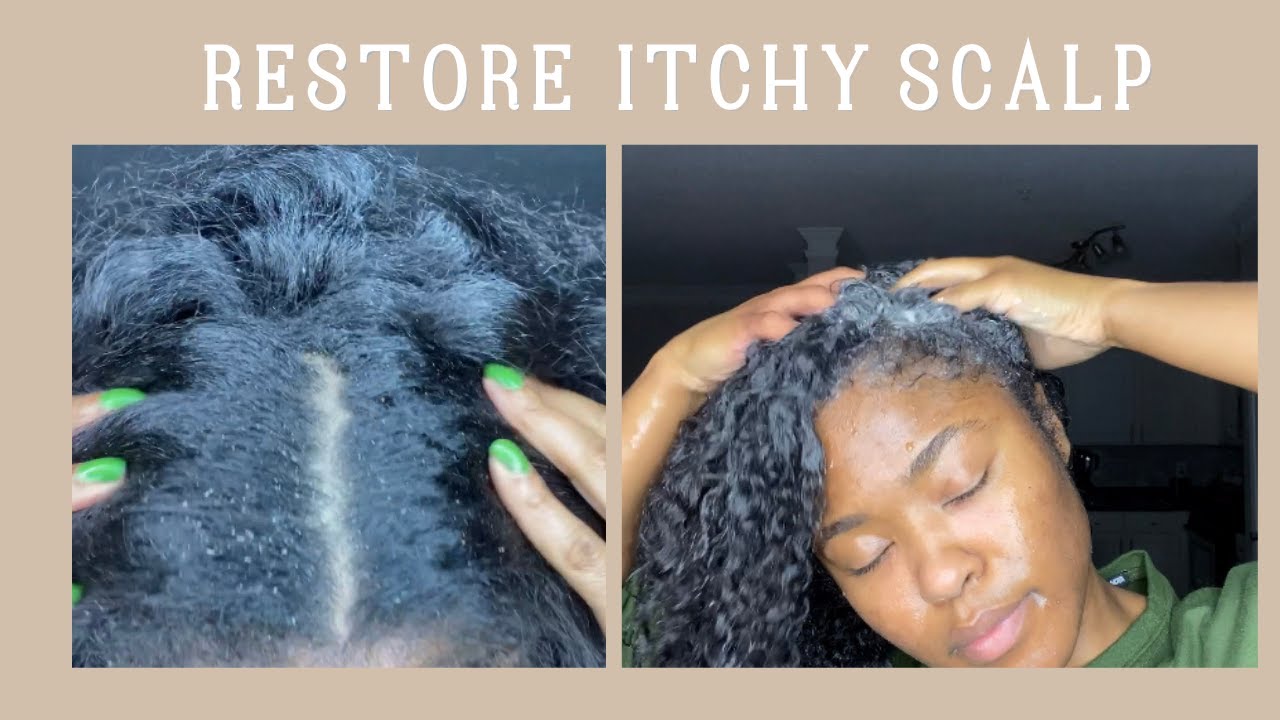 How To Get Rid of Itchy Scalp | Scalp Care | Raw Sugar