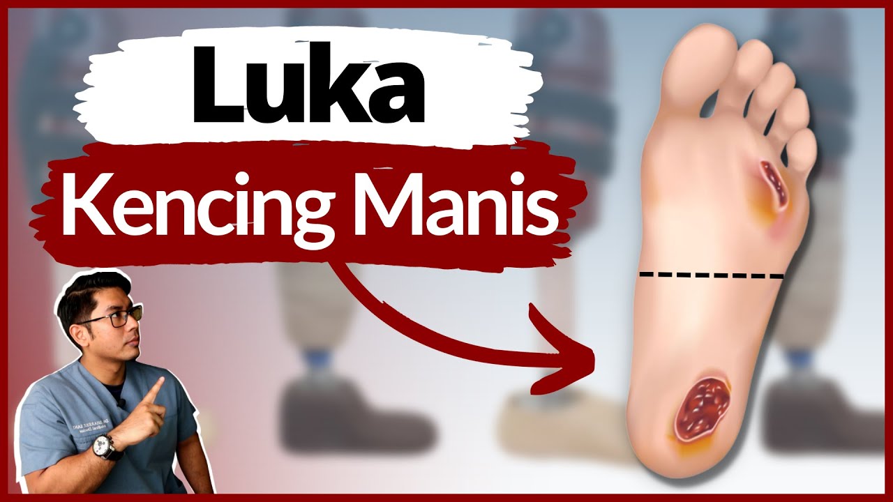 Bahaya Luka Kencing Manis | 5 Sebab Luka Lambat Sembuh |  | Doctor Sani |