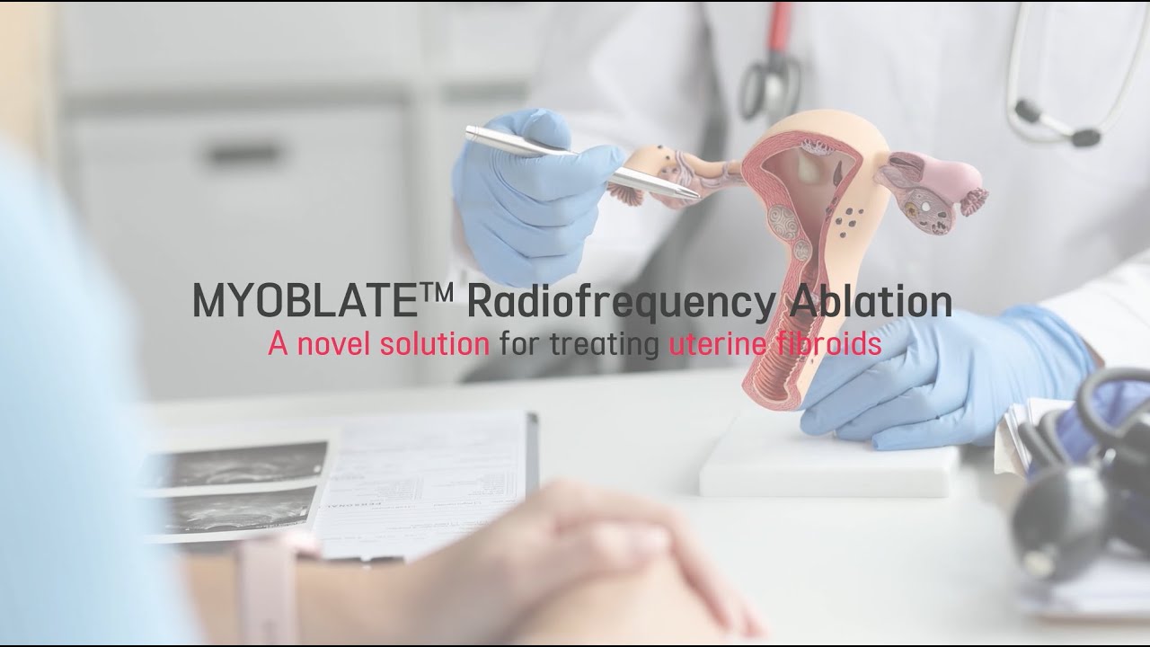 MYOBLATE™ Introduction of Uterine Fibroid RFA Procedure
