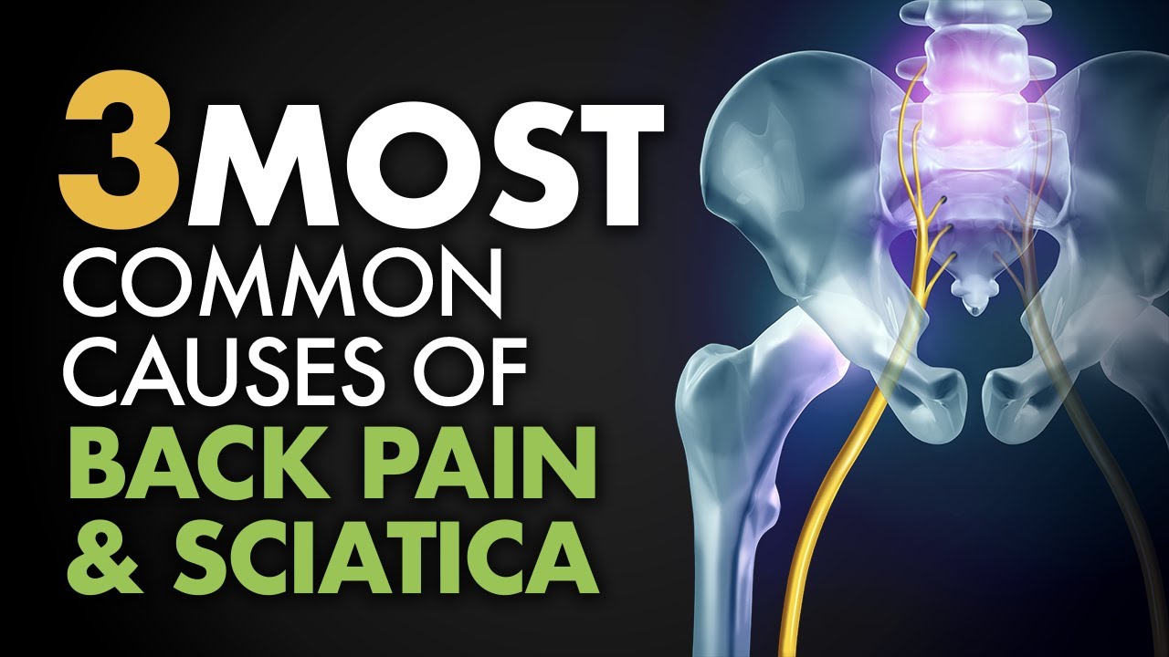 The 3 Most Common Causes of Back Pain & Sciatica