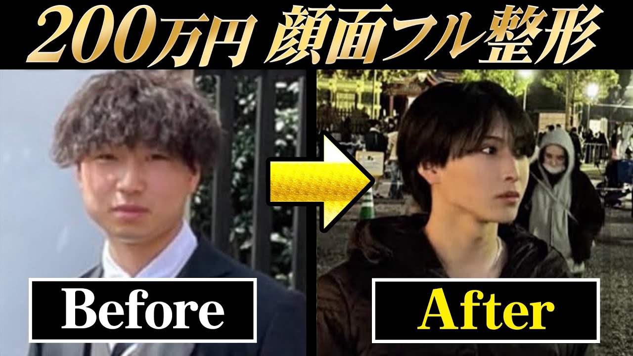 22歳になりました。18歳で整形を始めて、SNS発信で人生が変わった話