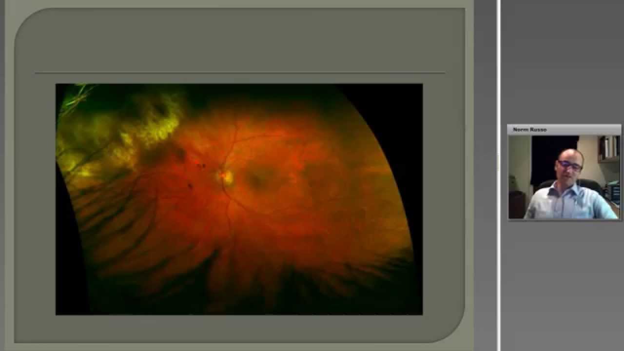Optos Webinar: How I made my optomap a success: Implementation into independent optometry practices
