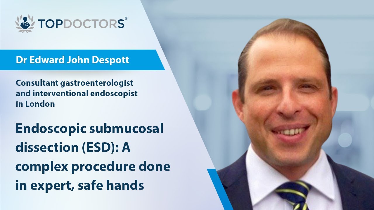 Endoscopic submucosal dissection (ESD): A complex procedure - Online interview