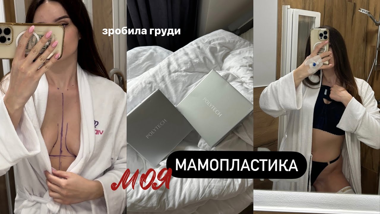 Моя мамопластика: операція, реабілітація, ціна, клініка