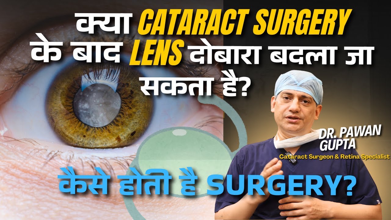 IOL Lens Exchange after Cataract Surgery - कब, क्यों और कैसे?| DR. PAWAN GUPTA