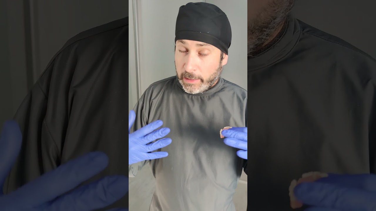 Te Demuestro porqu&eacute; LAS PR&Oacute;TESIS H&Iacute;BRIDAS SOBRE IMPLANTES suele ser una MALA OPCI&Oacute;N #shorts