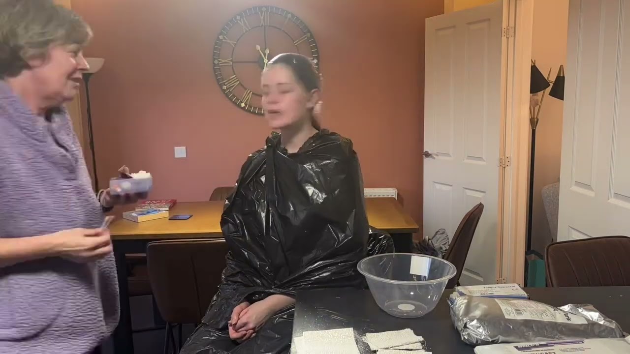 Lifecast and Removal